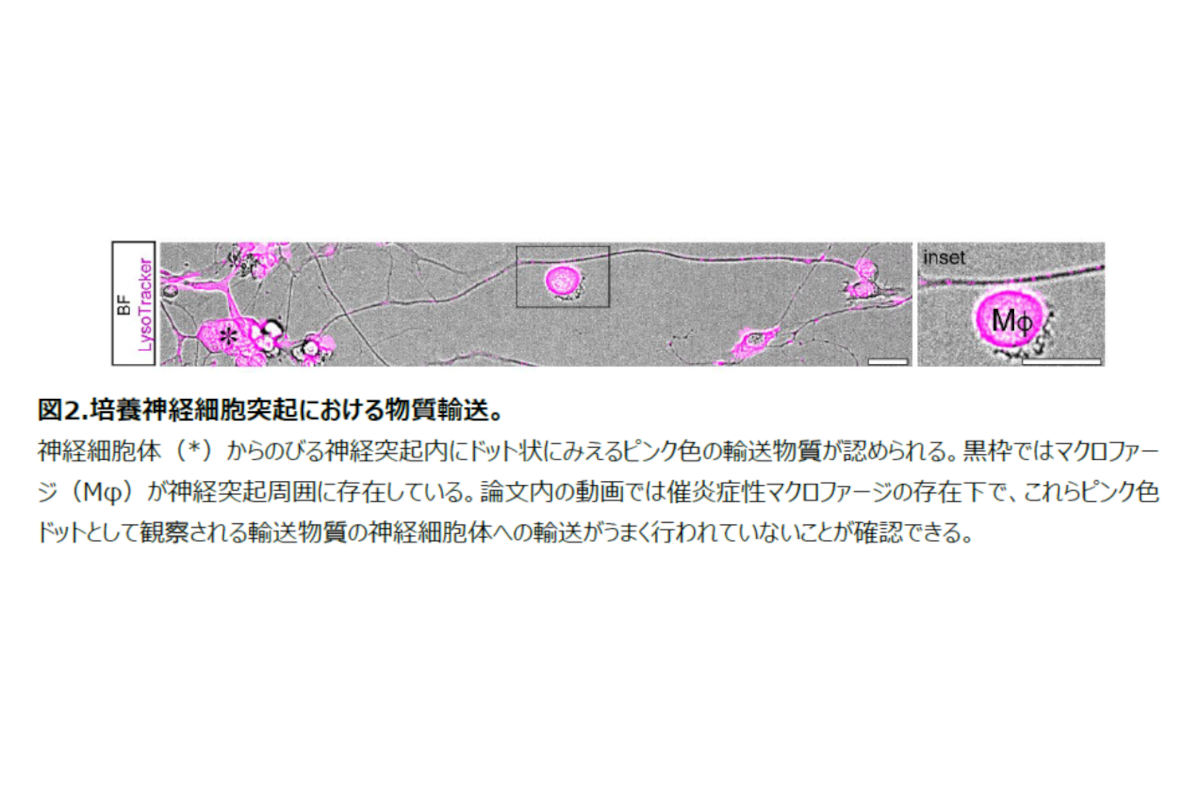 診断