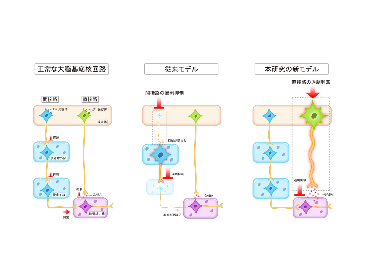 抗精神病薬の副作用である遅発性ジスキネジアの発症機序の解明 - 弘前大学