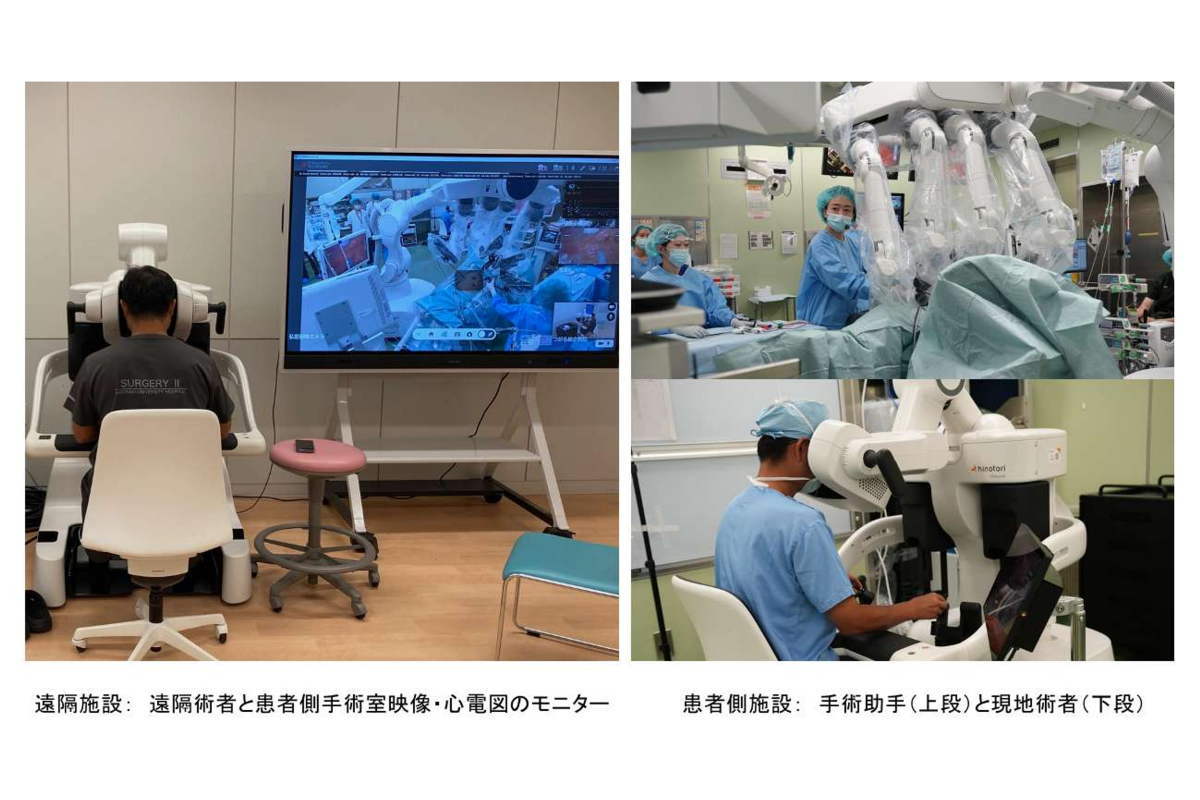 (左)遠隔施設:遠隔術者と患者側手術室映像・心電図のモニター
(右)患者側施設:手術助手(上段)と現地術者(下段)